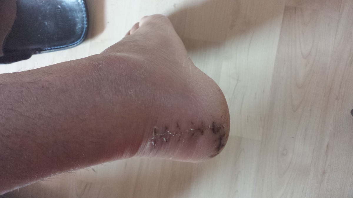 20150430_083135.jpg